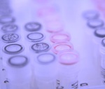 biomarker-raka-erc