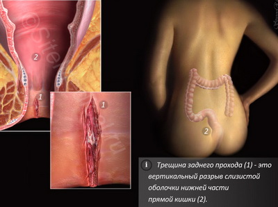 Анус человека — Википедия