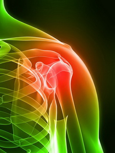 osteoporoz2